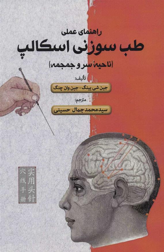 راهنمای علمی طب سوزنی اسکالپ