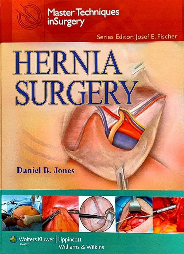 Master Techniques in Surgery Hernia